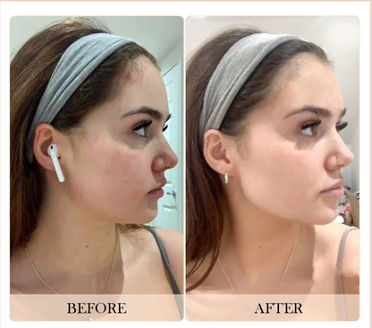 7-in-1 Beauty Massager for Face and Neck